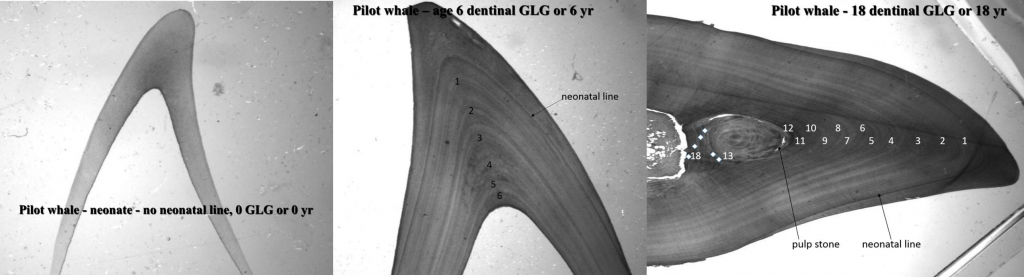 GLGs in pilot whale tooth